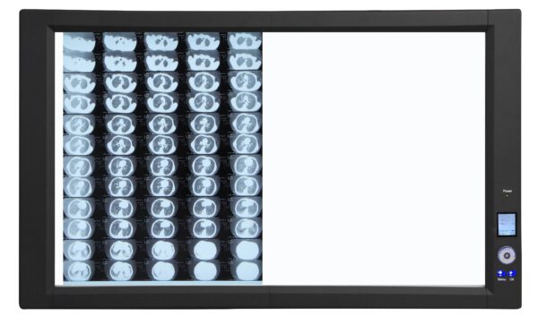 Negatoscopio de alto brillo LUMIX LED, doble campo